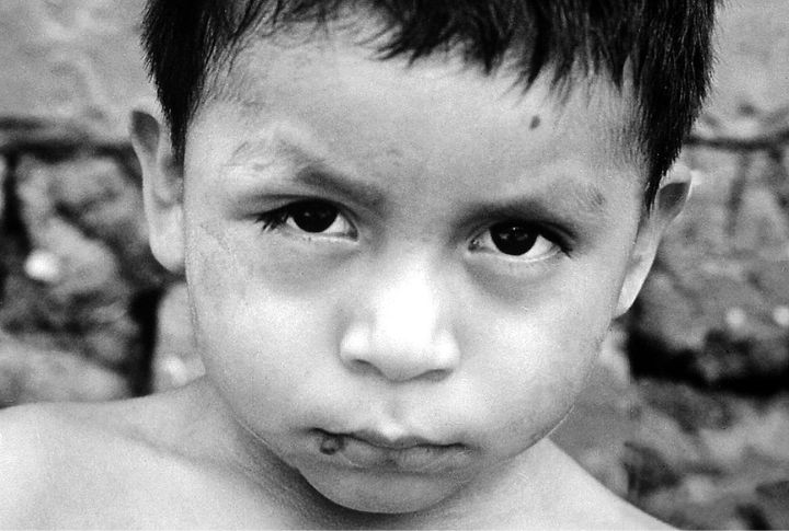 Malaria And Tropical Diseases Remain A Concern