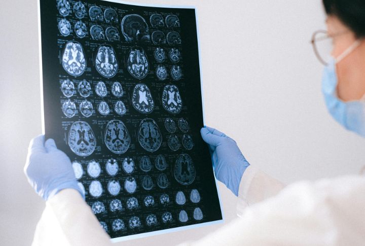 You Only Use 10% Of Your Brain Is A Myth